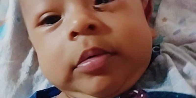 Cirurgia do bebê Henry, realizada pelo vereador Dr. Lívio, foi um sucesso.