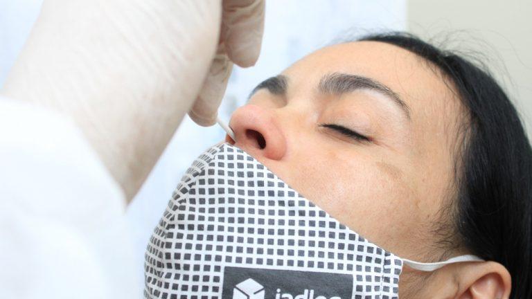 Campo Grande está entre as cinco cidades selecionadas  para participar de programa nacional de testagem.