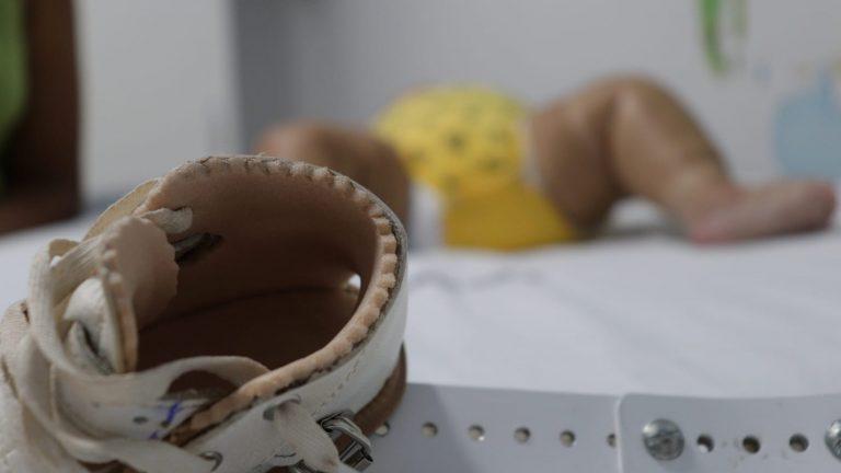 CRIANÇAS COM DEFORMIDADES ORTOPÉDICAS TÊM VIDAS TRANSFORMADAS COM ACESSO A CIRURGIAS E TRATAMENTO ADEQUADO.