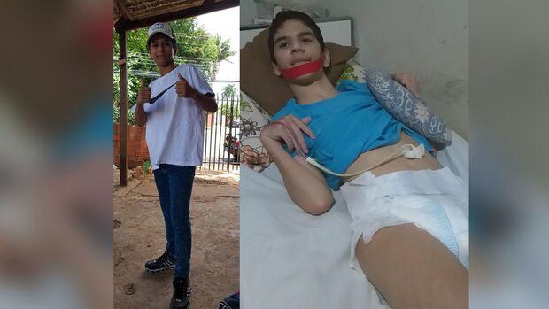 Mãe de adolescente atingido por descarga elétrica faz pastelada para custear tratamento Mãe de adolescente atingido por descarga elétrica faz pastelada para custear tratamento