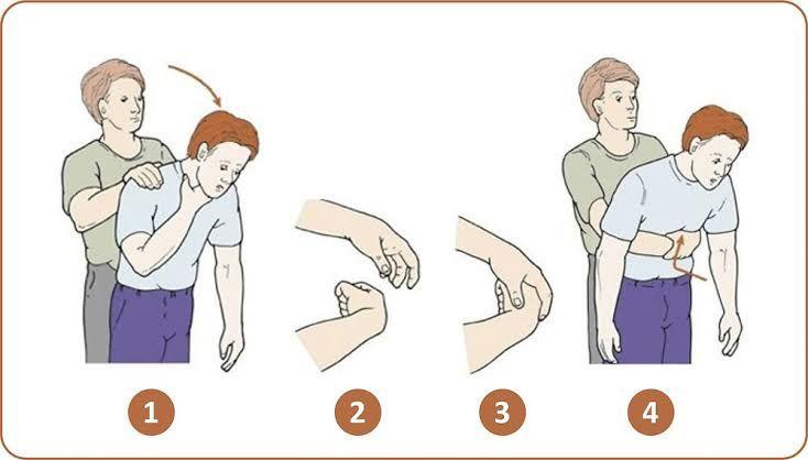 ‘Prevenir para Salvar’: Projeto da SESAU capacita população para atuar em emergências e reforça a nova Lei de Primeiros Socorros.