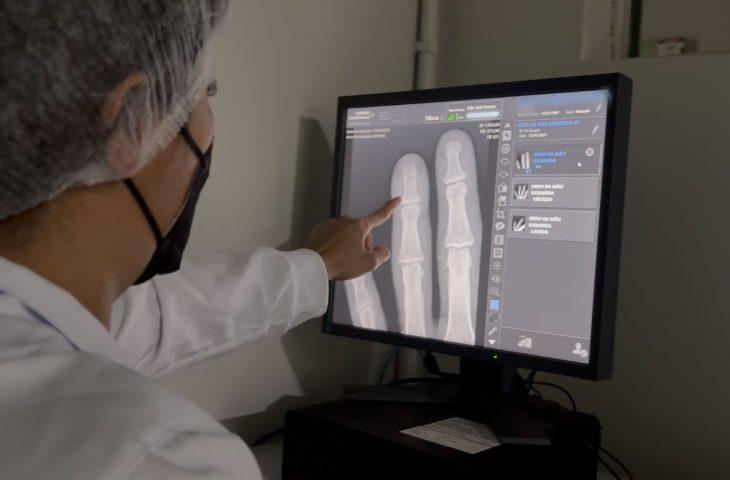 Governo entrega ultrassom e raio-x de alta resolução que ampliam precisão em mais de 600 exames por mês. Governo entrega ultrassom e raio-x de alta resolução que ampliam precisão em mais de 600 exames por mês.