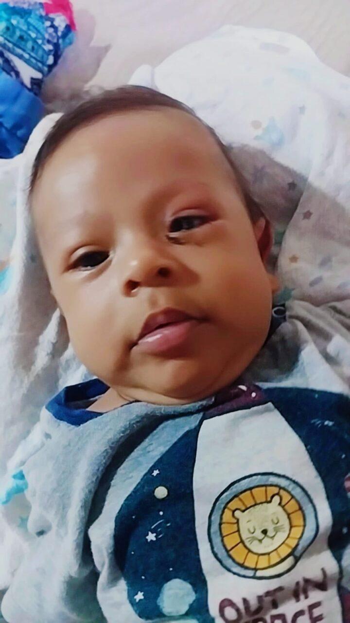 Cirurgia do bebê Henry, realizada pelo vereador Dr. Lívio, foi um sucesso. Cirurgia do bebê Henry, realizada pelo vereador Dr. Lívio, foi um sucesso.